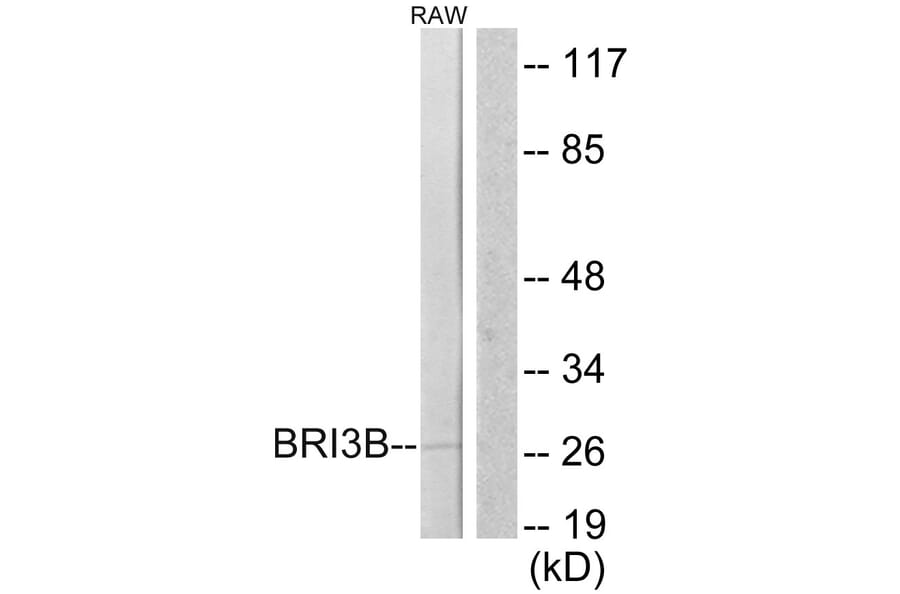 Western Blot - Anti-BRI3B Antibody (C11418) - Antibodies.com