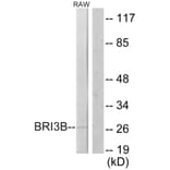 Western Blot - Anti-BRI3B Antibody (C11418) - Antibodies.com