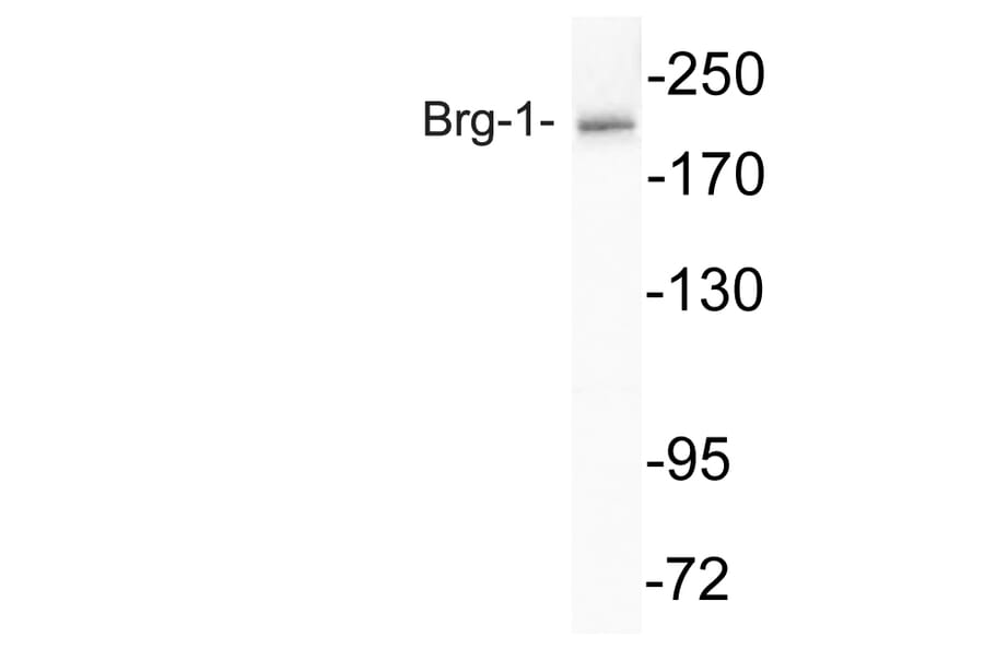 Western Blot - Anti-Brg-1 Antibody (R12-2044) - Antibodies.com