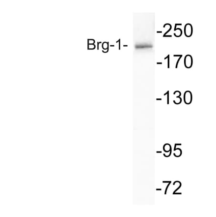 Western Blot - Anti-Brg-1 Antibody (R12-2044) - Antibodies.com