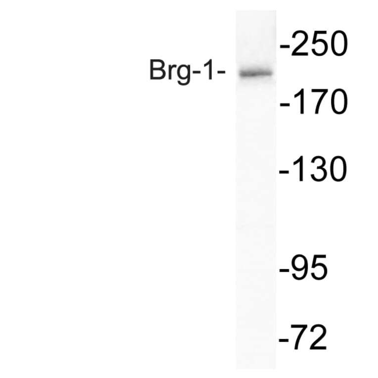 Western Blot - Anti-Brg-1 Antibody (R12-2044) - Antibodies.com