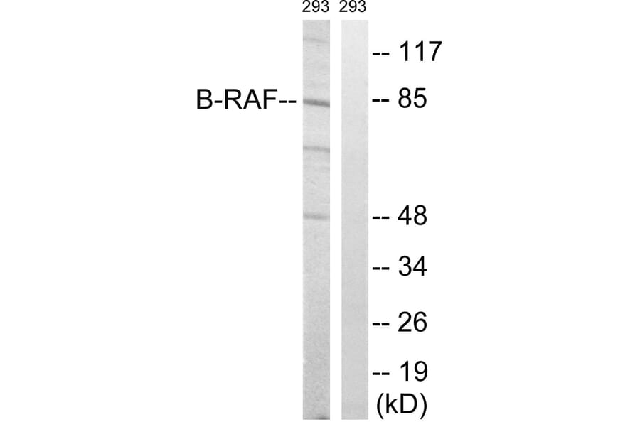 Western Blot - Anti-B-RAF Antibody (B8082) - Antibodies.com