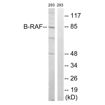 Western Blot - Anti-B-RAF Antibody (B8082) - Antibodies.com