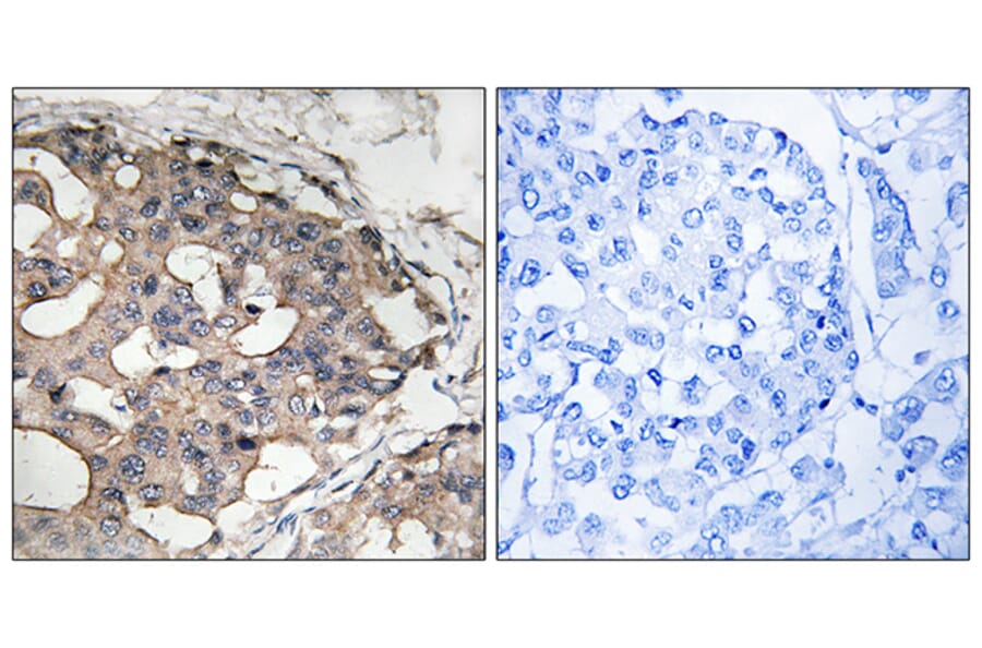 Immunohistochemistry - Anti-B-RAF Antibody (B8082) - Antibodies.com