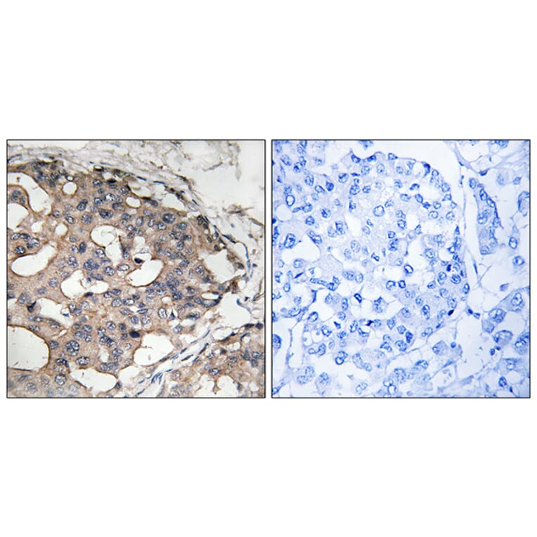 Immunohistochemistry - Anti-B-RAF Antibody (B8082) - Antibodies.com