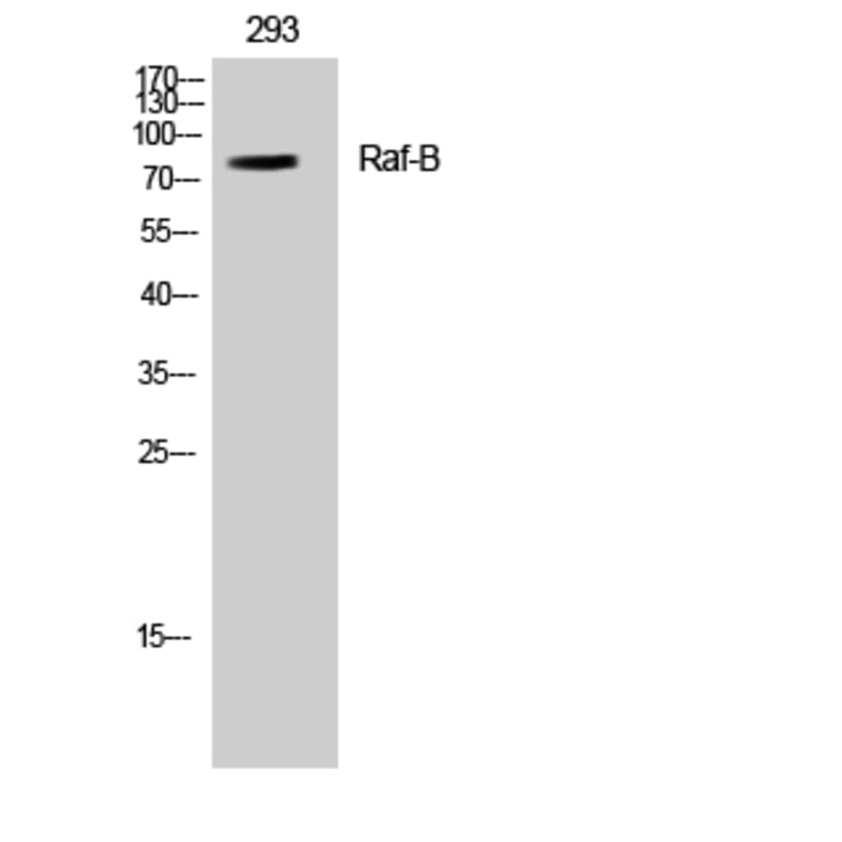 Western Blot - Anti-B-RAF Antibody (B8082) - Antibodies.com