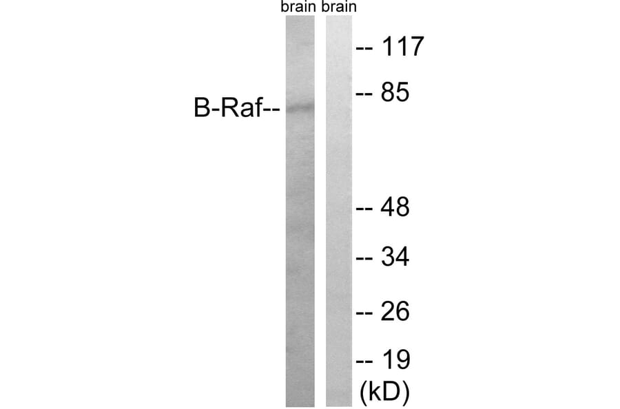 Western Blot - Anti-B-RAF Antibody (B8305) - Antibodies.com