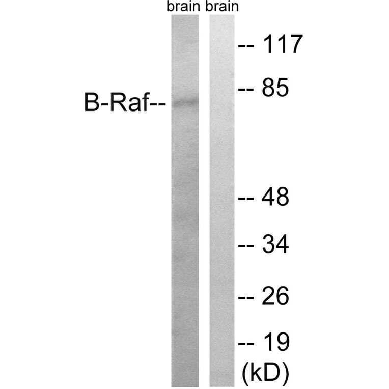 Western Blot - Anti-B-RAF Antibody (B8305) - Antibodies.com