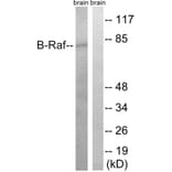 Western Blot - Anti-B-RAF Antibody (B8305) - Antibodies.com