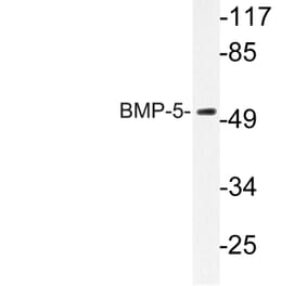Western Blot - Anti-BMP-5 Antibody (R12-2037) - Antibodies.com