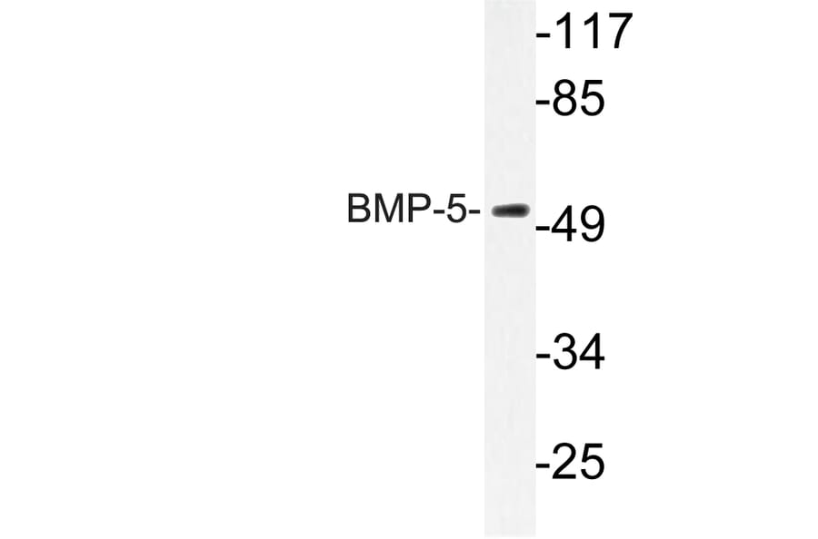 Western Blot - Anti-BMP-5 Antibody (R12-2037) - Antibodies.com