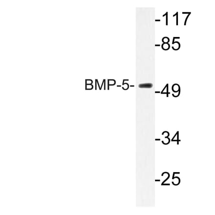 Western Blot - Anti-BMP-5 Antibody (R12-2037) - Antibodies.com