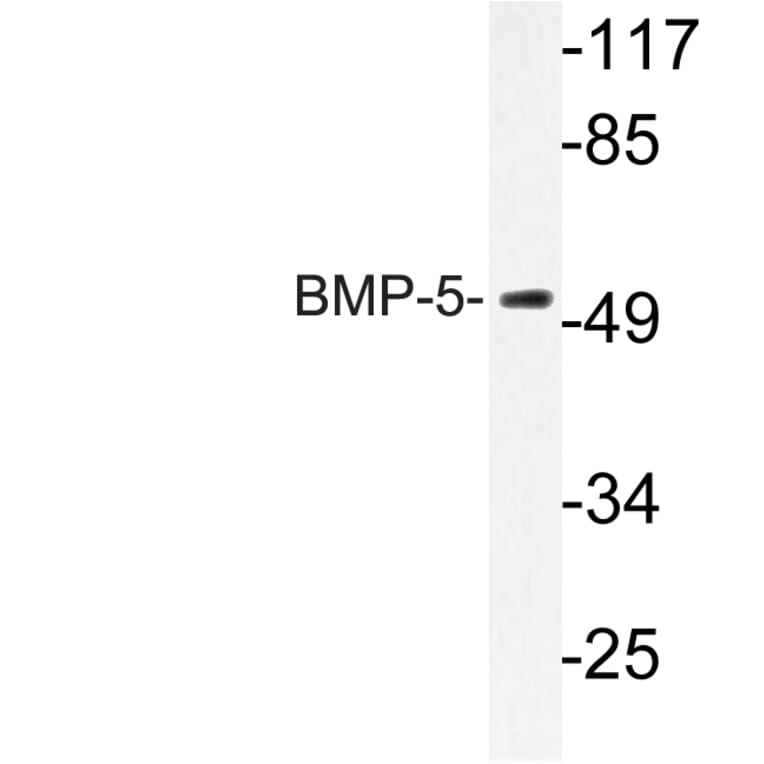 Western Blot - Anti-BMP-5 Antibody (R12-2037) - Antibodies.com