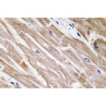 Immunohistochemistry - Anti-BMP-5 Antibody (R12-2037) - Antibodies.com