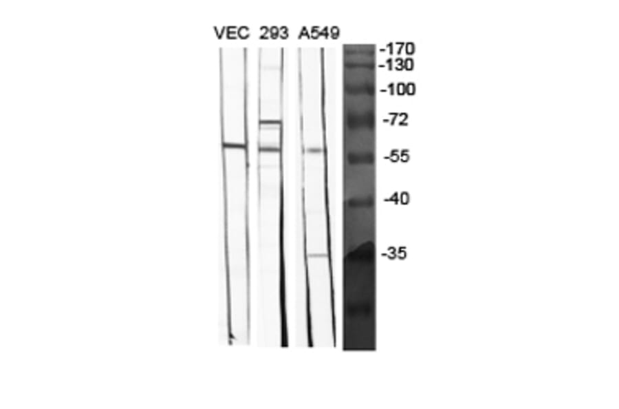 Western Blot - Anti-BMP-5 Antibody (R12-2037) - Antibodies.com