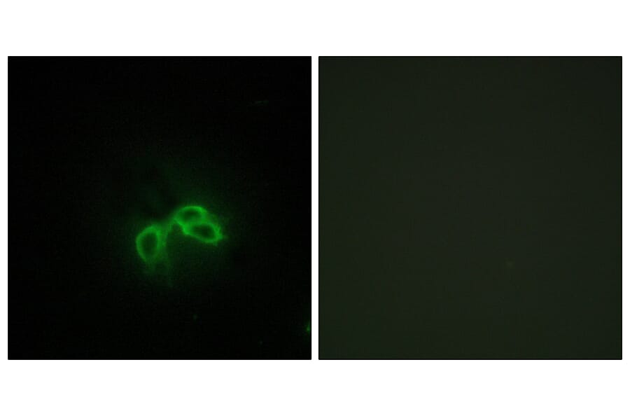 Immunofluorescence - Anti-BLCAP Antibody (C10782) - Antibodies.com