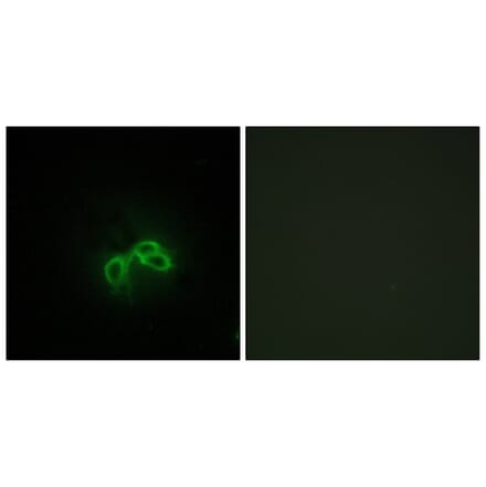 Immunofluorescence - Anti-BLCAP Antibody (C10782) - Antibodies.com