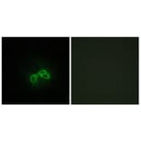 Immunofluorescence - Anti-BLCAP Antibody (C10782) - Antibodies.com