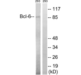 Western Blot - Anti-Bcl-6 Antibody (B8299) - Antibodies.com