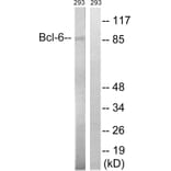 Western Blot - Anti-Bcl-6 Antibody (B8299) - Antibodies.com