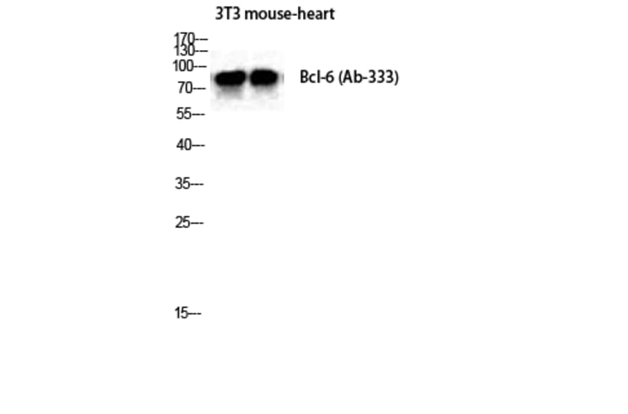 Western Blot - Anti-Bcl-6 Antibody (B8299) - Antibodies.com