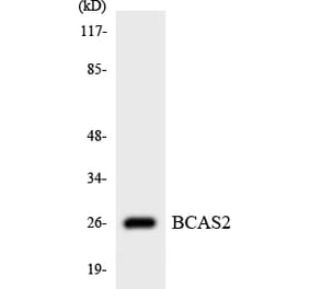 Western Blot - Anti-BCAS2 Antibody (R12-2539) - Antibodies.com