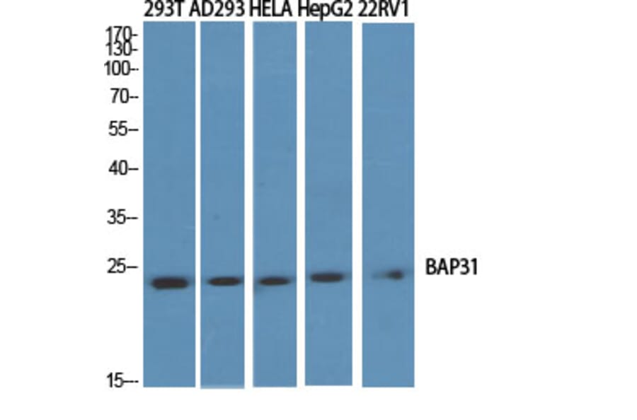 Western Blot - Anti-BAP31 Antibody (C10681) - Antibodies.com