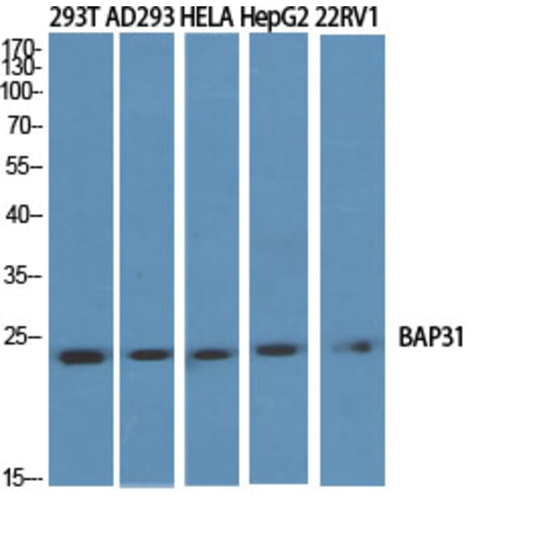 Western Blot - Anti-BAP31 Antibody (C10681) - Antibodies.com