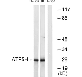 Western Blot - Anti-ATP5H Antibody (C14591) - Antibodies.com