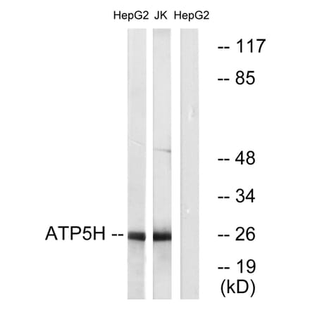 Western Blot - Anti-ATP5H Antibody (C14591) - Antibodies.com