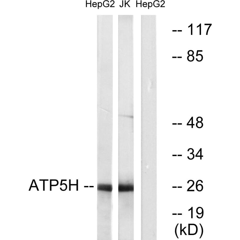 Western Blot - Anti-ATP5H Antibody (C14591) - Antibodies.com