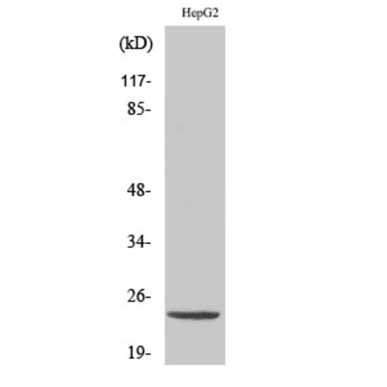 Western Blot - Anti-ATP5H Antibody (C14591) - Antibodies.com