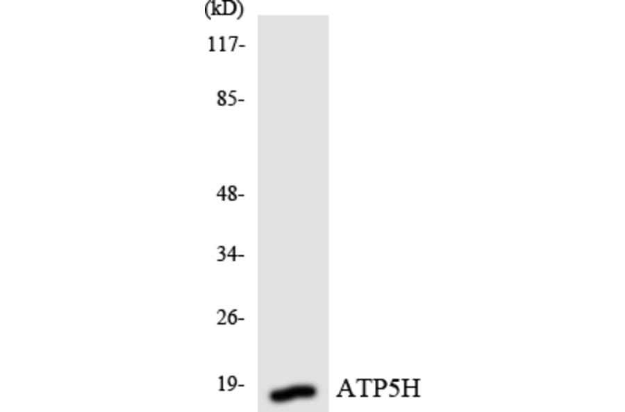 Western Blot - Anti-ATP5H Antibody (R12-2517) - Antibodies.com