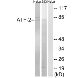Western Blot - Anti-ATF-2 Antibody (B8294) - Antibodies.com