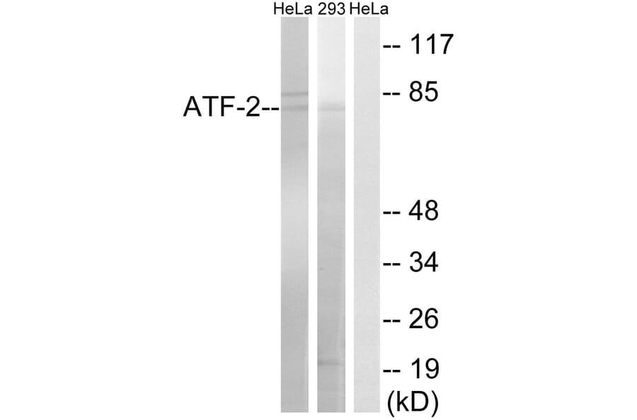 Western Blot - Anti-ATF-2 Antibody (B8294) - Antibodies.com
