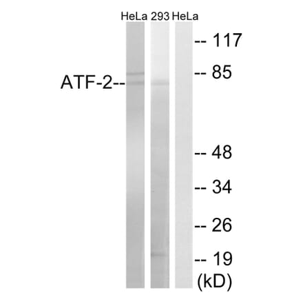 Western Blot - Anti-ATF-2 Antibody (B8294) - Antibodies.com