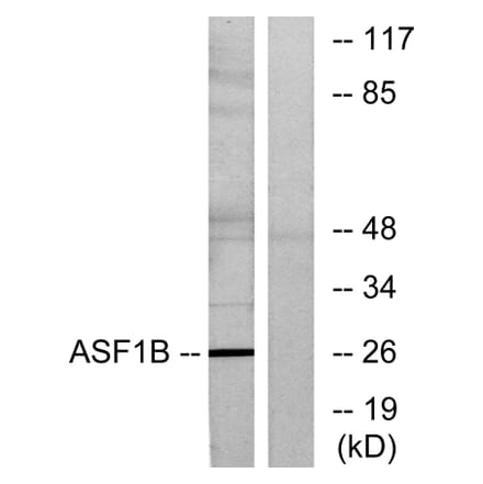 Western Blot - Anti-ASF1B Antibody (C11765) - Antibodies.com