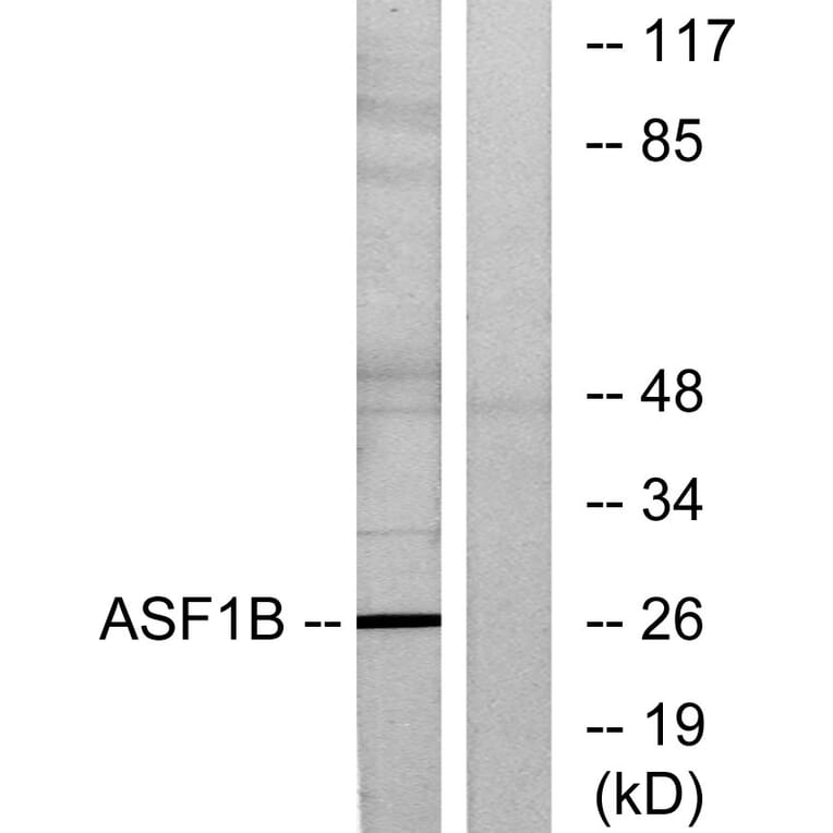 Western Blot - Anti-ASF1B Antibody (C11765) - Antibodies.com