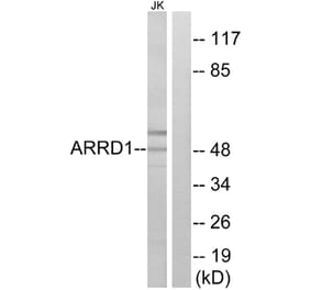 Western Blot - Anti-ARRD1 Antibody (C12059) - Antibodies.com