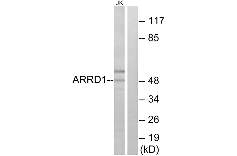 Western Blot - Anti-ARRD1 Antibody (C12059) - Antibodies.com