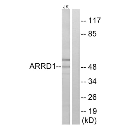 Western Blot - Anti-ARRD1 Antibody (C12059) - Antibodies.com