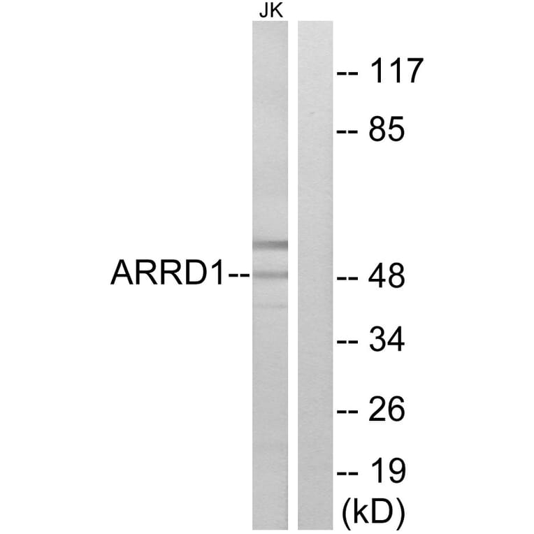 Western Blot - Anti-ARRD1 Antibody (C12059) - Antibodies.com