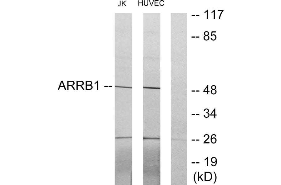 Western Blot - Anti-ARRB1 Antibody (C12056) - Antibodies.com