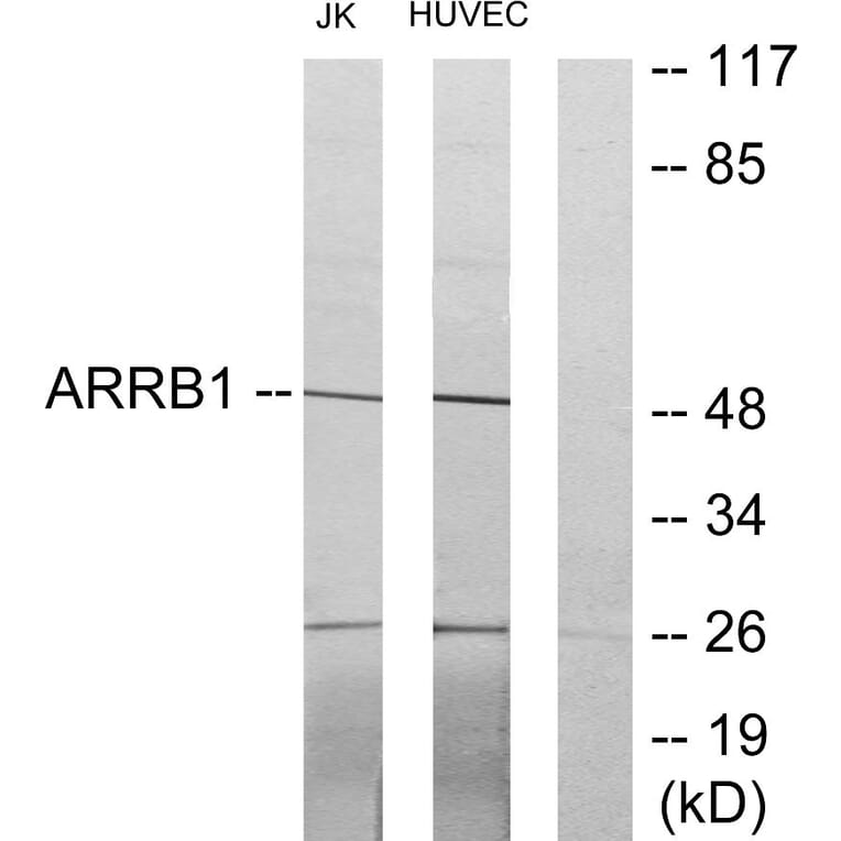 Western Blot - Anti-ARRB1 Antibody (C12056) - Antibodies.com