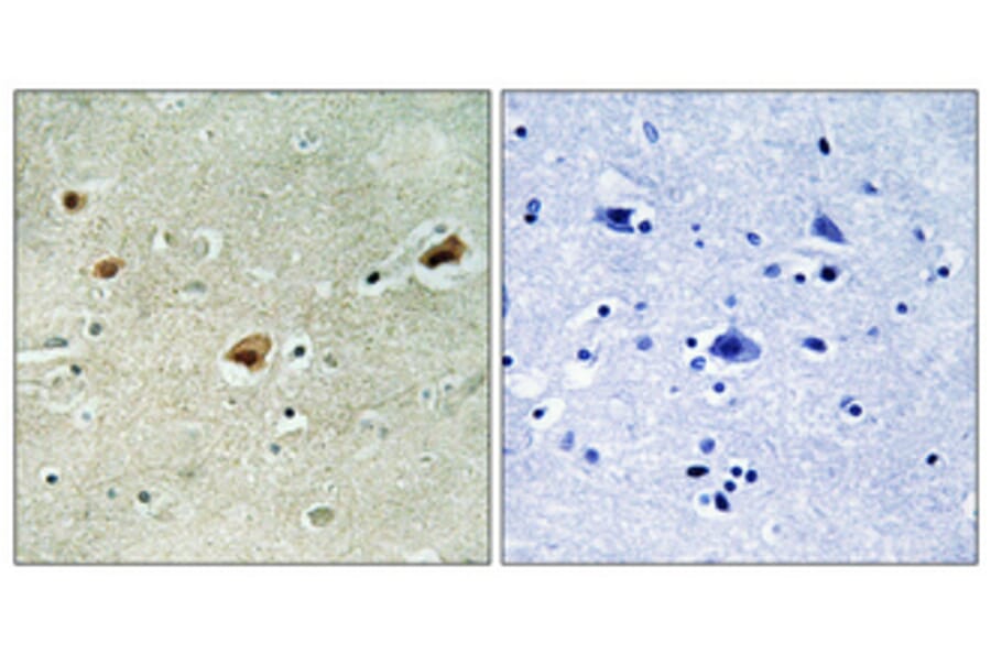 Immunohistochemistry - Anti-ARNT2 Antibody (C11723) - Antibodies.com