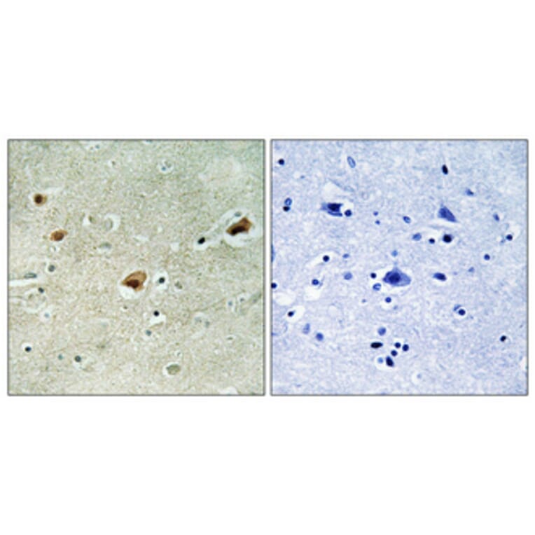 Immunohistochemistry - Anti-ARNT2 Antibody (C11723) - Antibodies.com