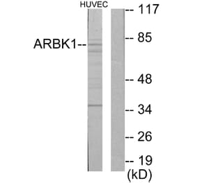 Western Blot - Anti-ARBK1 Antibody (C10475) - Antibodies.com