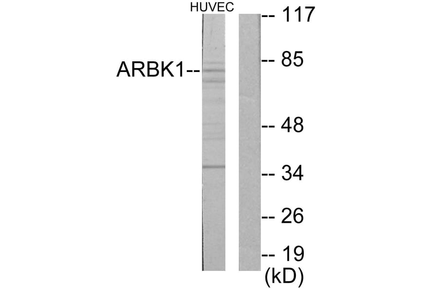 Western Blot - Anti-ARBK1 Antibody (C10475) - Antibodies.com