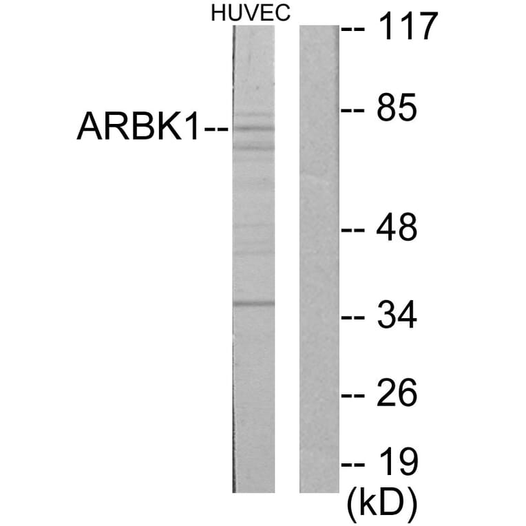 Western Blot - Anti-ARBK1 Antibody (C10475) - Antibodies.com