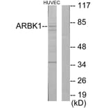 Western Blot - Anti-ARBK1 Antibody (C10475) - Antibodies.com